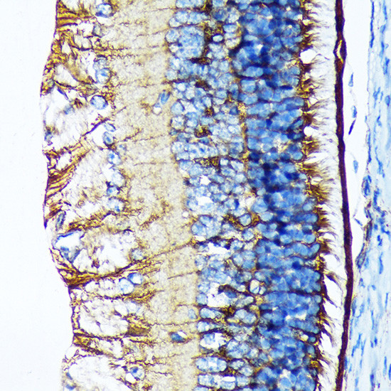 CRALBP Antibody in Immunohistochemistry (Paraffin) (IHC (P))