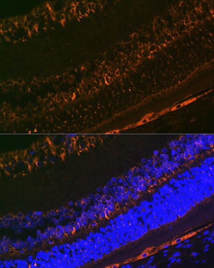 CRALBP Antibody in Immunohistochemistry (Paraffin) (IHC (P))