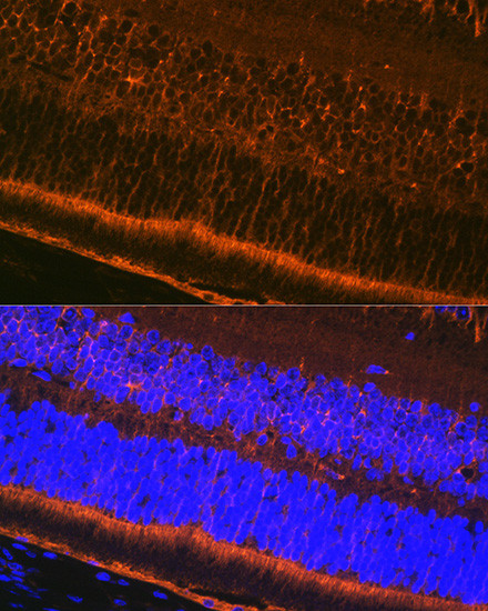 CRALBP Antibody in Immunohistochemistry (Paraffin) (IHC (P))