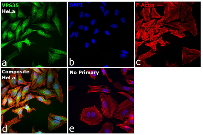 VPS35 Antibody in Immunocytochemistry (ICC/IF)