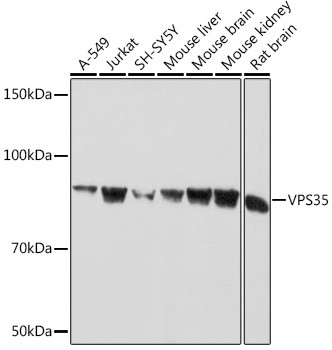 VPS35 Antibody in Western Blot (WB)