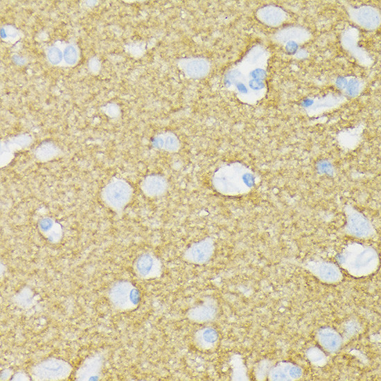 MUNC18 Antibody in Immunohistochemistry (Paraffin) (IHC (P))