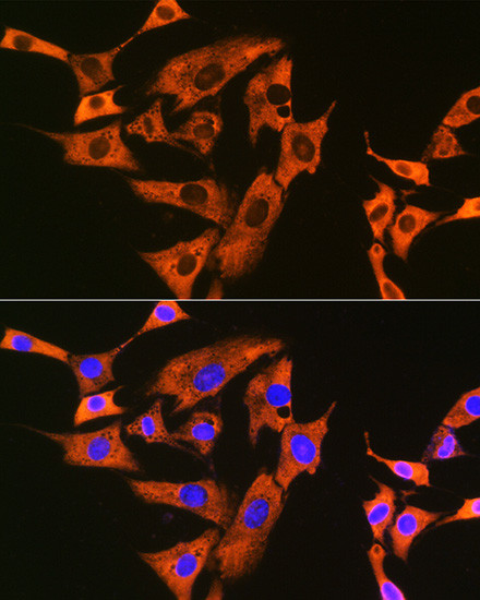 UQCRFS1 Antibody in Immunocytochemistry (ICC/IF)