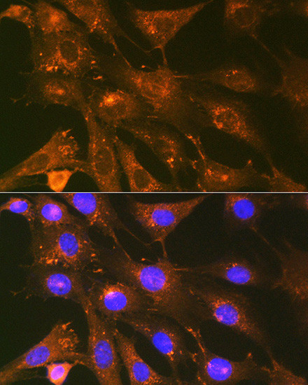 Cortactin Antibody in Immunocytochemistry (ICC/IF)