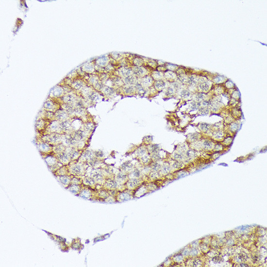 Cortactin Antibody in Immunohistochemistry (Paraffin) (IHC (P))