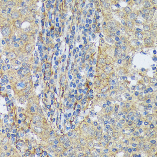 Cortactin Antibody in Immunohistochemistry (Paraffin) (IHC (P))