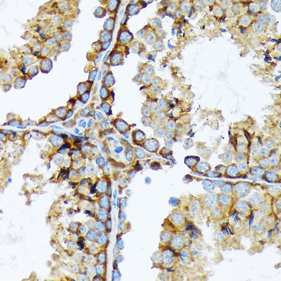 Cortactin Antibody in Immunohistochemistry (Paraffin) (IHC (P))