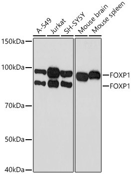 FOXP1 Antibody in Western Blot (WB)