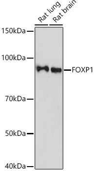 FOXP1 Antibody in Western Blot (WB)