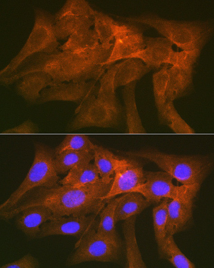 SIRP alpha Antibody in Immunocytochemistry (ICC/IF)