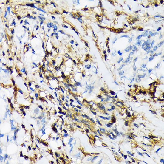 PSMB9 Antibody in Immunohistochemistry (Paraffin) (IHC (P))