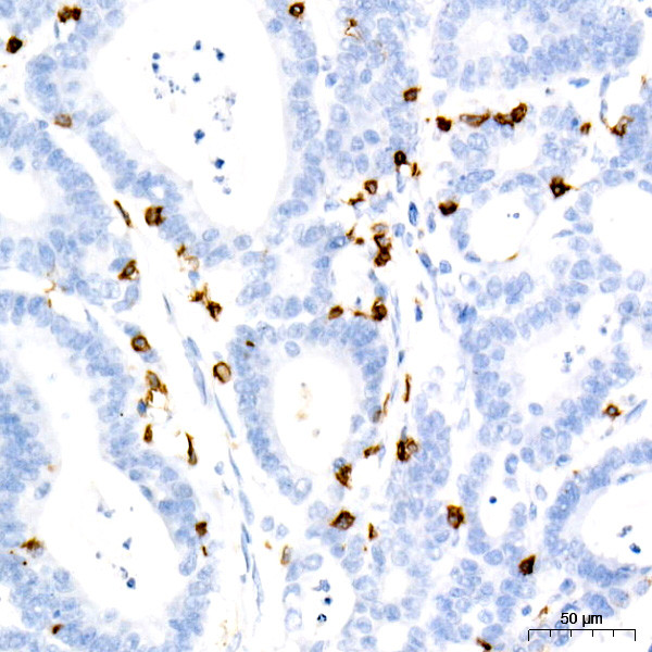 CD7 Antibody in Immunohistochemistry (Paraffin) (IHC (P))