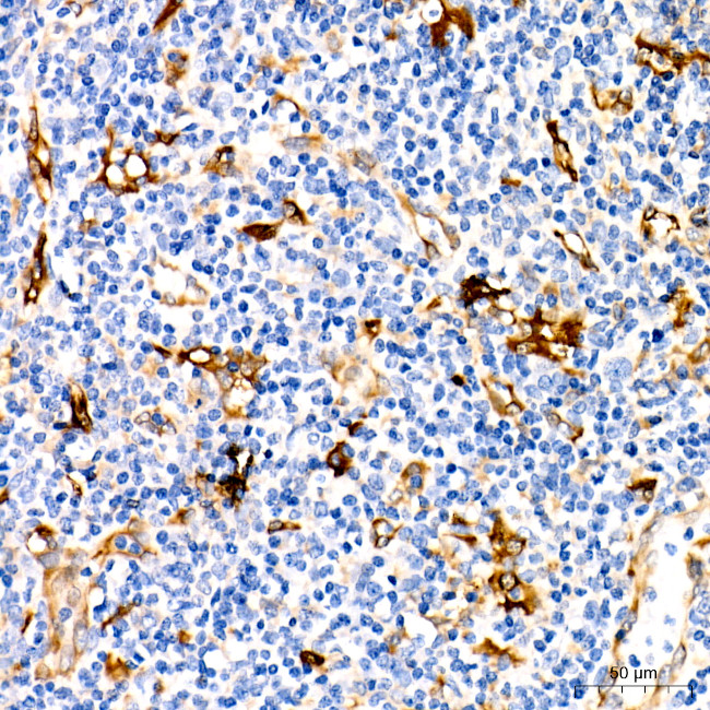 Fascin Antibody in Immunohistochemistry (Paraffin) (IHC (P))