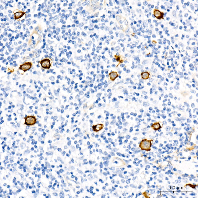 Fascin Antibody in Immunohistochemistry (Paraffin) (IHC (P))