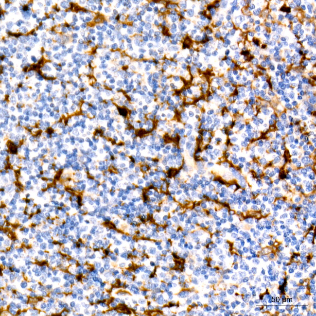 Fascin Antibody in Immunohistochemistry (Paraffin) (IHC (P))