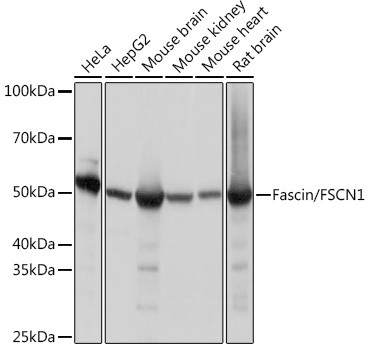 Fascin Antibody in Western Blot (WB)