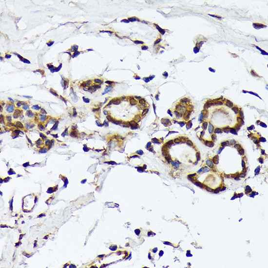 PSMD14 Antibody in Immunohistochemistry (Paraffin) (IHC (P))