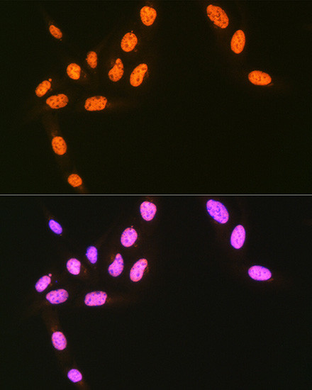 HnRNP Q Antibody in Immunocytochemistry (ICC/IF)