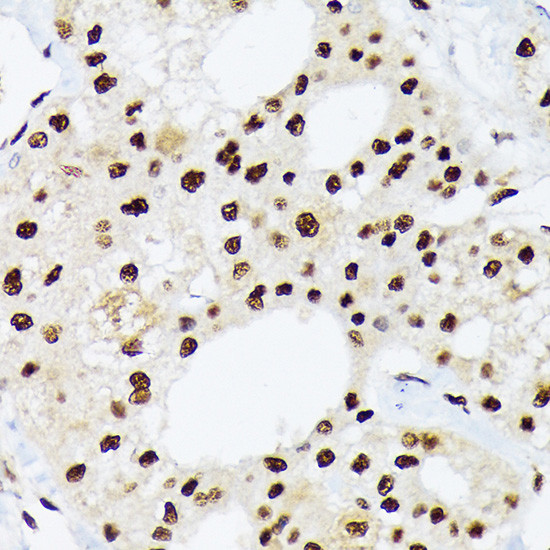 HnRNP Q Antibody in Immunohistochemistry (Paraffin) (IHC (P))