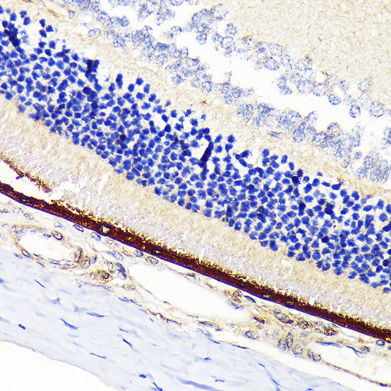 RPE65 Antibody in Immunohistochemistry (Paraffin) (IHC (P))