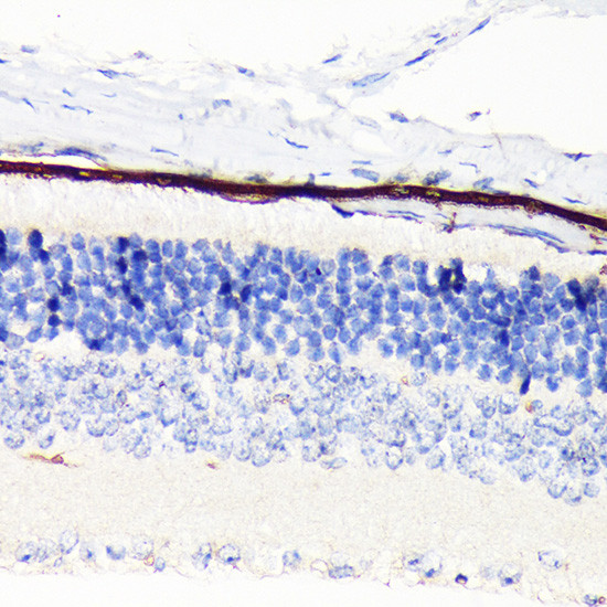 RPE65 Antibody in Immunohistochemistry (Paraffin) (IHC (P))