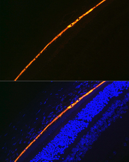 RPE65 Antibody in Immunohistochemistry (Paraffin) (IHC (P))