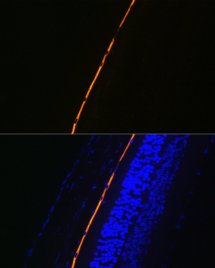 RPE65 Antibody in Immunohistochemistry (Paraffin) (IHC (P))