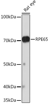 RPE65 Antibody in Western Blot (WB)