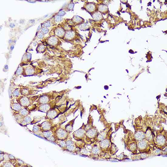 Nectin 2 Antibody in Immunohistochemistry (Paraffin) (IHC (P))