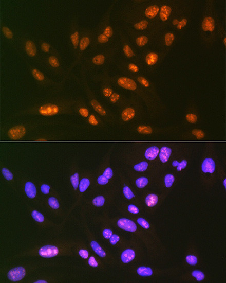 SF3B3 Antibody in Immunocytochemistry (ICC/IF)