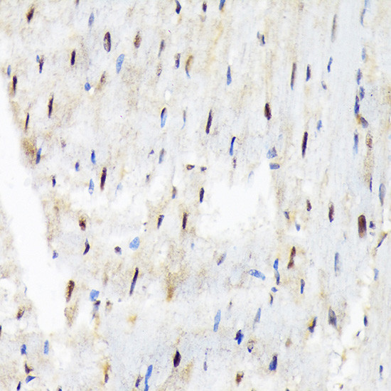 SF3B3 Antibody in Immunohistochemistry (Paraffin) (IHC (P))