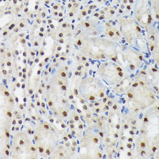 SF3B3 Antibody in Immunohistochemistry (Paraffin) (IHC (P))