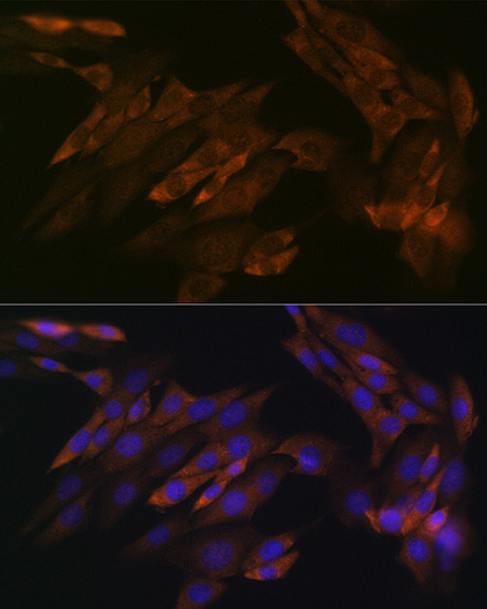 DDX6 Antibody in Immunocytochemistry (ICC/IF)