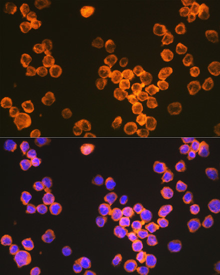 DC-SIGN Antibody in Immunocytochemistry (ICC/IF)