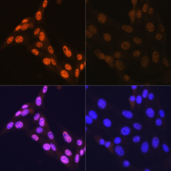 Phospho-JNK1/JNK2/JNK3 (Thr183, Thr221) Antibody in Immunocytochemistry (ICC/IF)