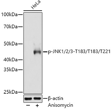 Phospho-JNK1/JNK2/JNK3 (Thr183, Thr221) Antibody in Western Blot (WB)