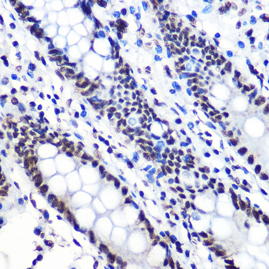 Phospho-IkB alpha (Ser36) Antibody in Immunohistochemistry (Paraffin) (IHC (P))