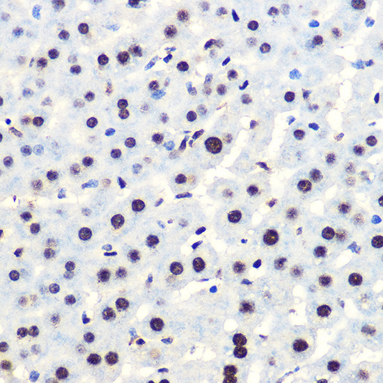 Phospho-IkB alpha (Ser36) Antibody in Immunohistochemistry (Paraffin) (IHC (P))