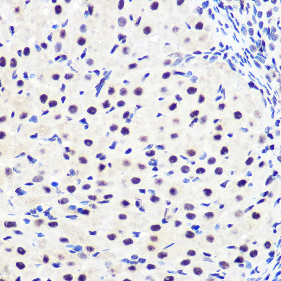 Phospho-IkB alpha (Ser36) Antibody in Immunohistochemistry (Paraffin) (IHC (P))