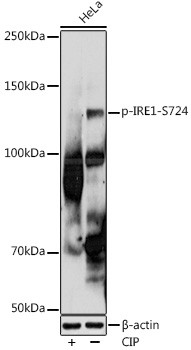 Phospho-IRE1 alpha (Ser724) Antibody in Western Blot (WB)