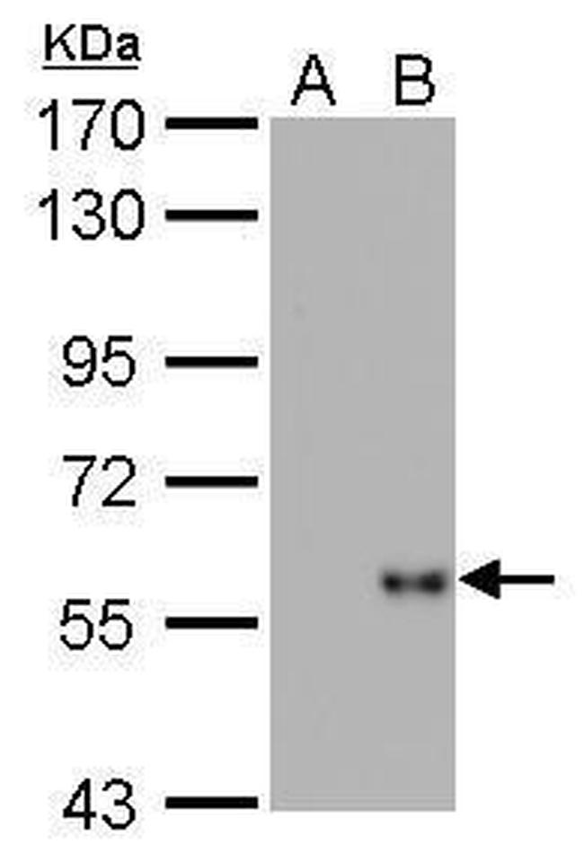 Influenza A H1N1 NP Antibody in Western Blot (WB)