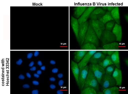 Influenza B NP Antibody in Immunocytochemistry (ICC/IF)