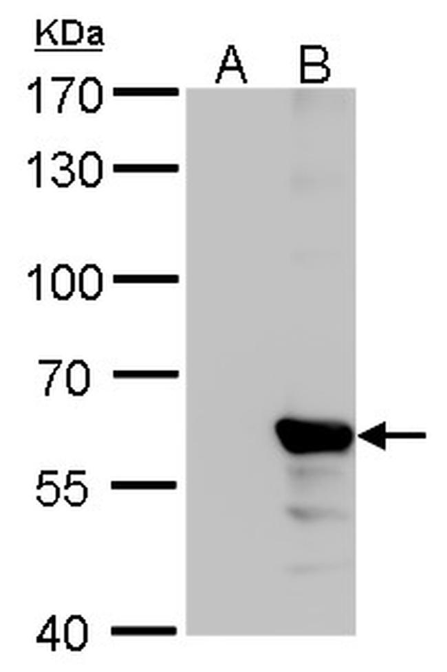 Influenza B NP Antibody in Western Blot (WB)