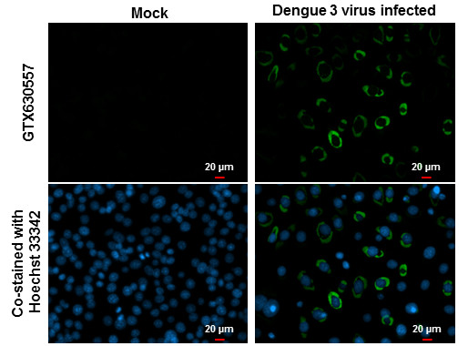 Dengue Virus Type 2 NS1 Antibody in Immunocytochemistry (ICC/IF)