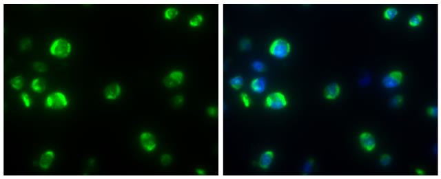 Dengue Virus Type 2 Capsid Antibody in Immunocytochemistry (ICC/IF)