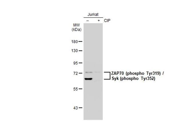 Phospho-Zap-70 (Tyr319, Tyr352) Antibody in Western Blot (WB)