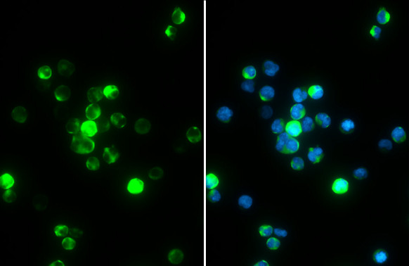 Phospho-Zap-70 (Tyr319, Tyr352) Antibody in Immunocytochemistry (ICC/IF)