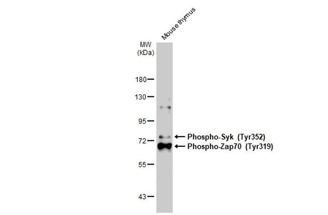 Phospho-Zap-70 (Tyr319, Tyr352) Antibody in Western Blot (WB)