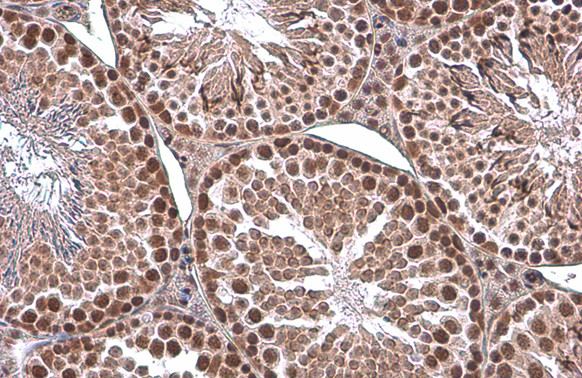 EED Antibody in Immunohistochemistry (Paraffin) (IHC (P))