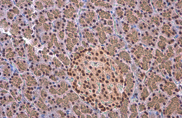 EED Antibody in Immunohistochemistry (Paraffin) (IHC (P))